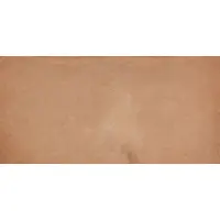 10 000 000 Mark Reichsbahndirektion