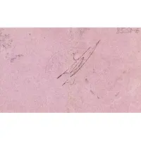 25 Céntimos Albanchez de Úbeda